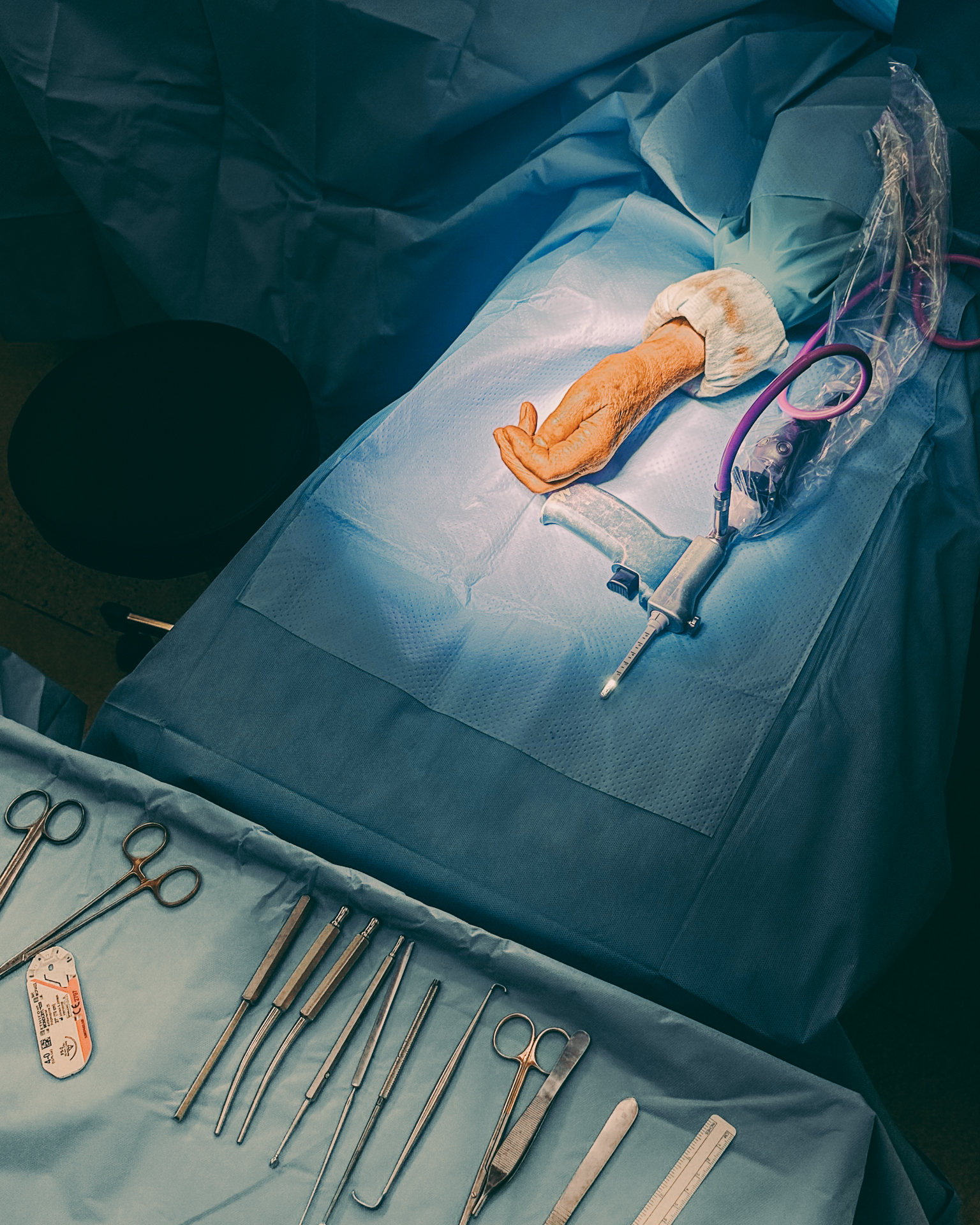 3 months in a surgery room.